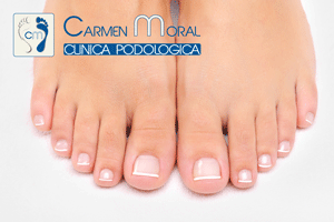 El hongo de las uñas en los pies el yodo y el vinagre
